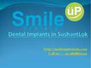 Dental Implants in SushantLok