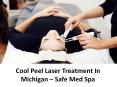 Cool Peel Laser Treatment In Michigan – Safe Med Spa PowerPoint PPT Presentation