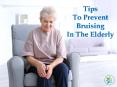 Tips To Prevent Bruising In The Elderly PowerPoint PPT Presentation
