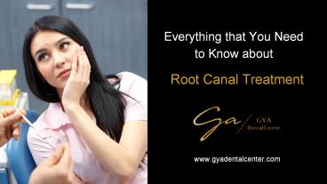 Root Canal Treatment Dubai (1)