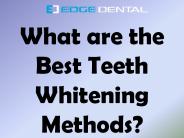 What are the Best Teeth Whitening Methods?