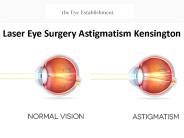 Laser Eye Surgery Astigmatism Kensington