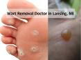 Wart Removal Doctor in Lansing and Mt. Pleasant, Michigan PowerPoint PPT Presentation