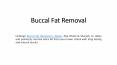 Buccal Fat Removal PowerPoint PPT Presentation