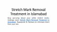 Stretch Marks Removal in Islamabad PowerPoint PPT Presentation