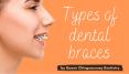 Dental Braces Types by Queen Chinguacousy Dentistry PowerPoint PPT Presentation