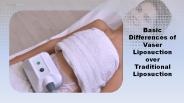 Basic Differences of Vaser Liposuction over Traditional Liposuction