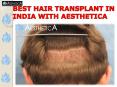 BEST HAIR TRANSPLANT IN INDIA WITH AESTHETICA PowerPoint PPT Presentation