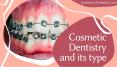 What are Cosmetic Dentistry and Procedure of Cosmetic Dental PowerPoint PPT Presentation