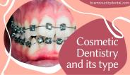 What are Cosmetic Dentistry and Procedure of Cosmetic Dental