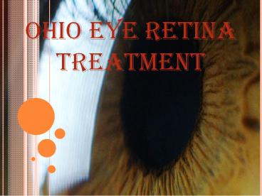Ohio eye retina treatment