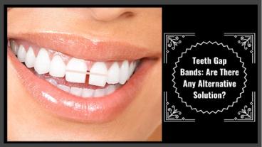 Teeth Gap Bands: Are There Any Alternative Solution?