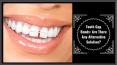 Teeth Gap Bands: Are There Any Alternative Solution? PowerPoint PPT Presentation