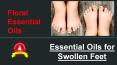 Pure And Natural Essential Oils for Swollen Feet - Floral Essential Oils PowerPoint PPT Presentation