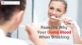 Reasons Why Your Gums Bleed When You Brush Your Teeth PowerPoint PPT Presentation