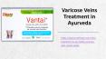 varicose veins treatment in ayurveda PowerPoint PPT Presentation