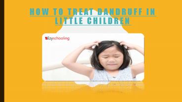 how to treat dandruff