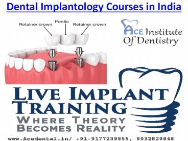 Dental Implant Courses in Hyderabad India | Practice with Seniors