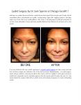 Eyelid Surgery by Dr. Sam Speron at Chicago Facelift ! PowerPoint PPT Presentation