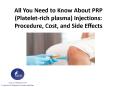 All You Need to Know About Platelet-rich plasma Injections Procedure Cost and Side Effects PowerPoint PPT Presentation