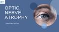 Stem Cell Therapy for Optic Nerve Atrophy PowerPoint PPT Presentation