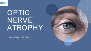 Stem Cell Therapy for Optic Nerve Atrophy