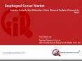 Esophageal Cancer Market Size Estimates, Share Analysis, Growth Factors | Forecast till 2023 PowerPoint PPT Presentation
