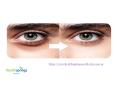 Get Premium Eye Bags Removal Treatment and Cellulite Removal Treatment at Aesthetic Clinics in Singapore PowerPoint PPT Presentation