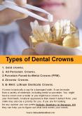 Types of Dental Crowns PowerPoint PPT Presentation