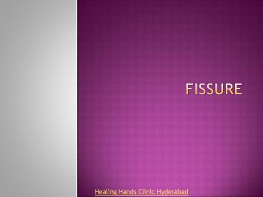What is Anal Fissure?