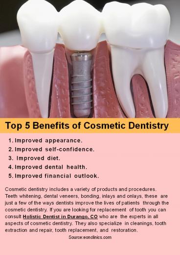 Top 5 Benefits of Cosmetic Dentistry