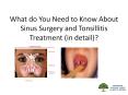 What do You Need to Know About Sinus Surgery and Tonsillitis Treatment (in detail)? PowerPoint PPT Presentation