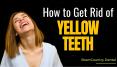 How to Get Rid of Yellow Teeth by Dentist in Brampton PowerPoint PPT Presentation