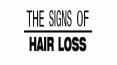 The signs of hair loss PowerPoint PPT Presentation