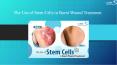 The Use of Stem Cells in Burnt Wound Treatment PowerPoint PPT Presentation