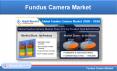 Fundus Camera Market Share by Product type, End-Users & Regions PowerPoint PPT Presentation