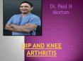 Hip and Knee Arthritis PowerPoint PPT Presentation