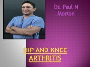 Hip and Knee Arthritis