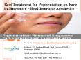 Best Treatment for Pigmentation on Face in Singapore at Healthsprings Aesthetics PowerPoint PPT Presentation