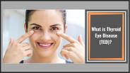 What is Thyroid Eye Disease (TED)?