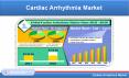 Cardiac Arrhythmia Market by Segment, Region, End-User, & Key Players PowerPoint PPT Presentation