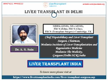 Top Liver Transplant in Delhi