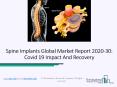 Spine Implants Market 2020 Industry Share, Growth Opportunity Forecasts 2020-2023 PowerPoint PPT Presentation