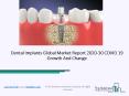 (2020-2030) Dental Implants Market Size, Share, Growth And Trends PowerPoint PPT Presentation