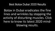 Best Botox Dubai 2020 Results