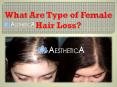 What Are Type of Female Hair Loss? PowerPoint PPT Presentation