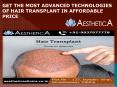 GET THE MOST ADVANCED TECHNOLOGIES OF HAIR TRANSPLANT IN AFFORDABLE PRICE PowerPoint PPT Presentation