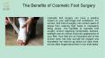 Get Your Best Foot Surgeon in Miami Beach, FL PowerPoint PPT Presentation