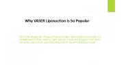 Why VASER Liposuction Is So Popular