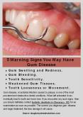 5 Warning Signs You May Have Gum Disease PowerPoint PPT Presentation